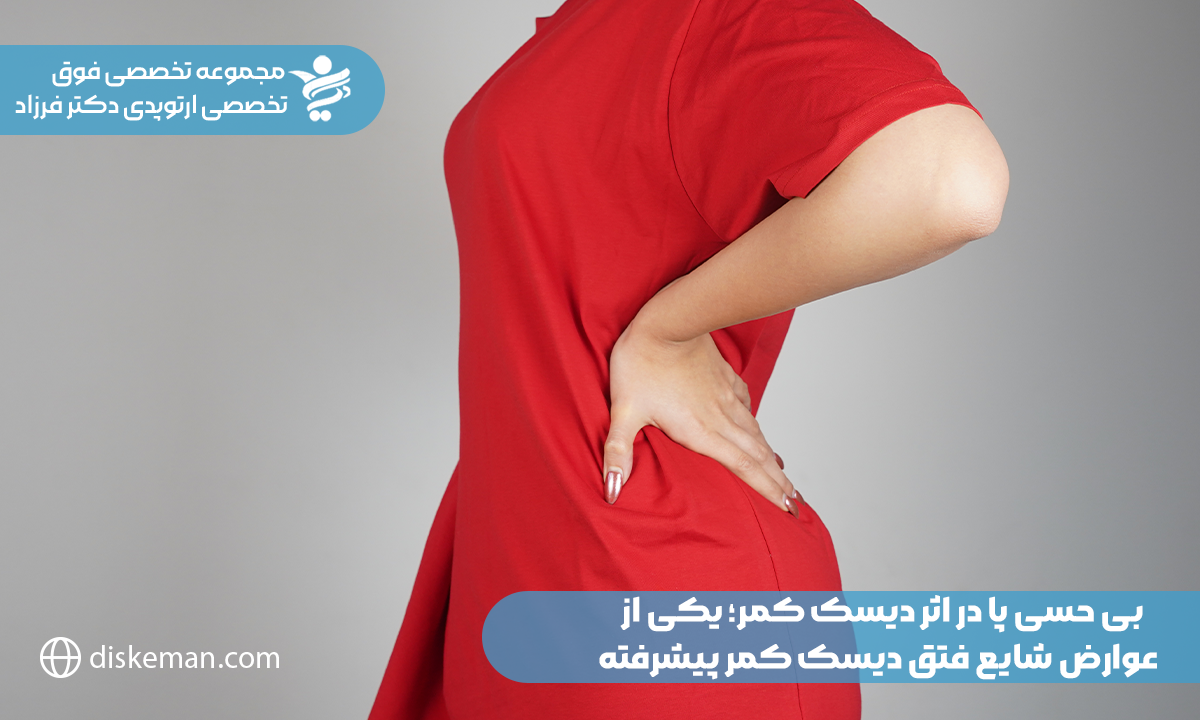 بی حسی پا در اثر دیسک کمر؛ یکی از عوارض شایع فتق دیسک کمر پیشرفته